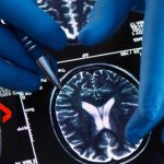 HIV Drug Could CRUSH Brain Cancer