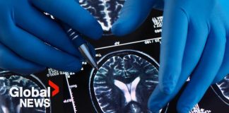 HIV Drug Could CRUSH Brain Cancer HIV Drug Could CRUSH Brain Cancer